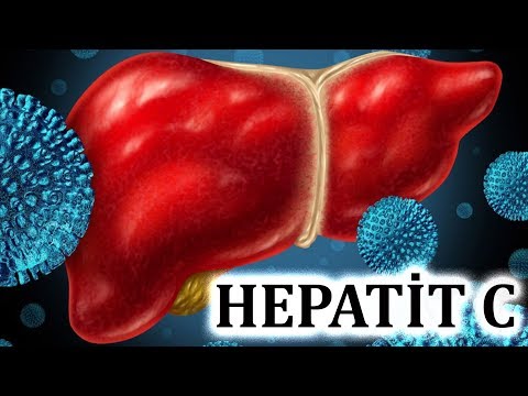 Hepatit C necə müalicə olunur?