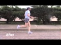 Running- Sciatica and Hamstring Pain Gone with Running Form Correction