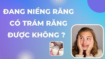 Đang niềng răng có trám răng được không | Tt niềng răng quốc tế Diamond