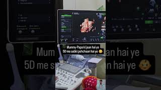 Mom challange live baby birth normal delivery #viralvideo #youtube #newbornbaby