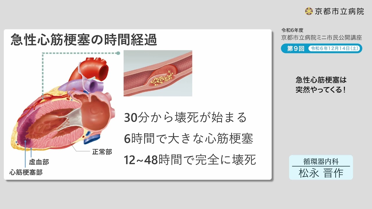 京都市立病院】令和6年度ミニ市民公開講座 第9回「急性心筋梗塞は