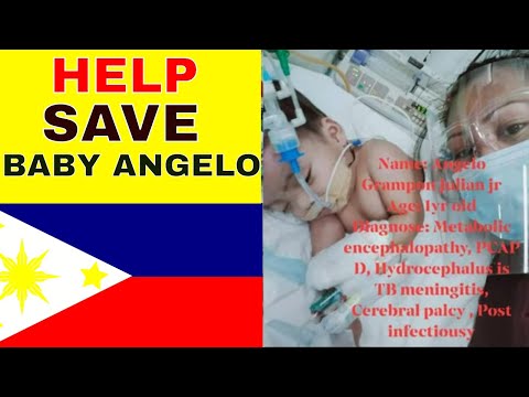 PHILIPPINES 🇵🇭TRYING TO SAVE BABY ANGELO.PAULSOUTDOOR R.I.P ANGELO🥲