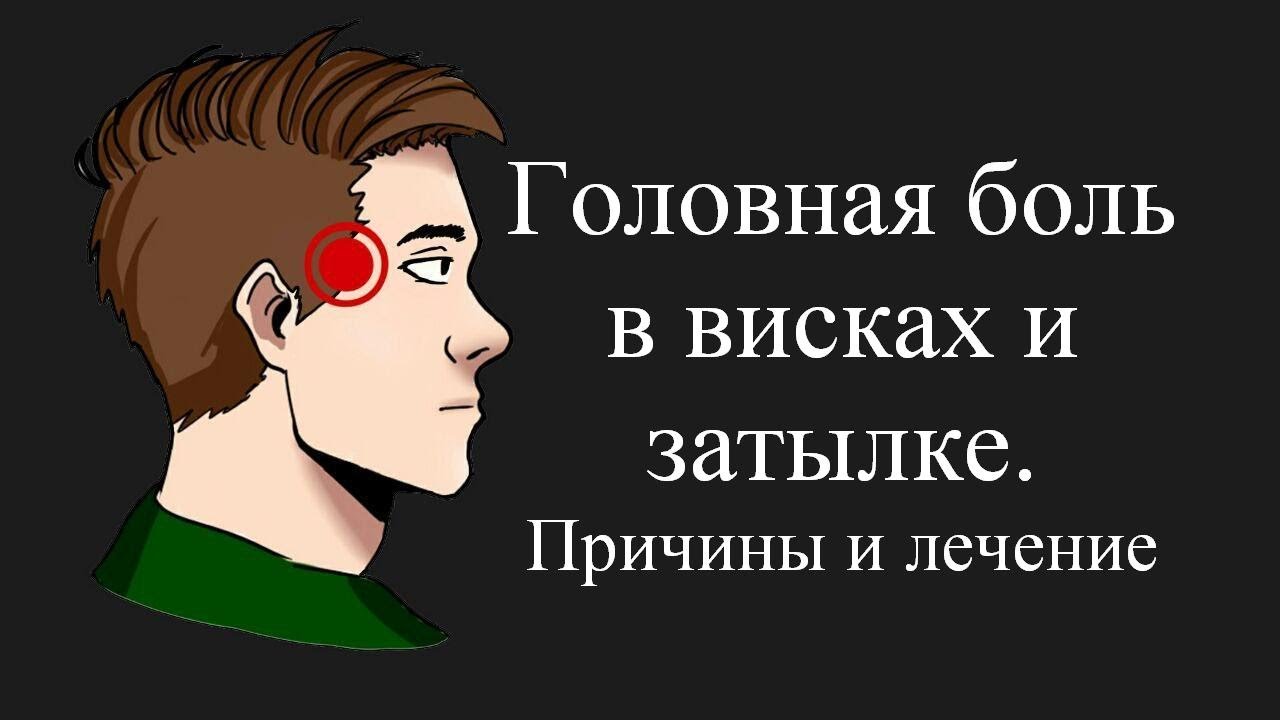 Острая боль в затылке. Головная боль в затылке и висках. Голованя боль в затылке. Болит голова в висках. Боль в затылке головы причины.