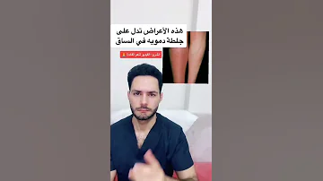 احذر من هذه الأعراض قد تدل على جلطة في ساق د خلدون الحوراني 