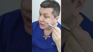 Как убрать морщины марионетки и подтянуть лицо?