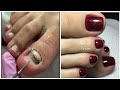 Most Satisfying Pedicure transformation 😱 best nail polish for toes 2020
