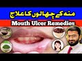 Mouth Sores:Causes &amp; Treatment of Mouth Soreness in Urdu/Hindi|Home Remedies@herbalistnoman9965