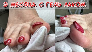 видео: 2 месяца с гельлаком. Обработка пяток при педикюре. Трещины на пятках как убрать? Как делать педикюр картинка: 2 месяца с гельлаком. Обработка пяток при педикюре. Трещины на пятках как убрать? Как делать педикюр