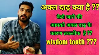 अक्ल दाढ़ क्या है ?? Wisdom Tooth? Symptom Of Problm In Wisdom Tooth ??