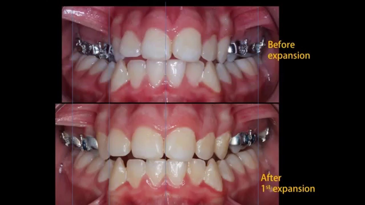 Orthodontics for Dummies YouTube