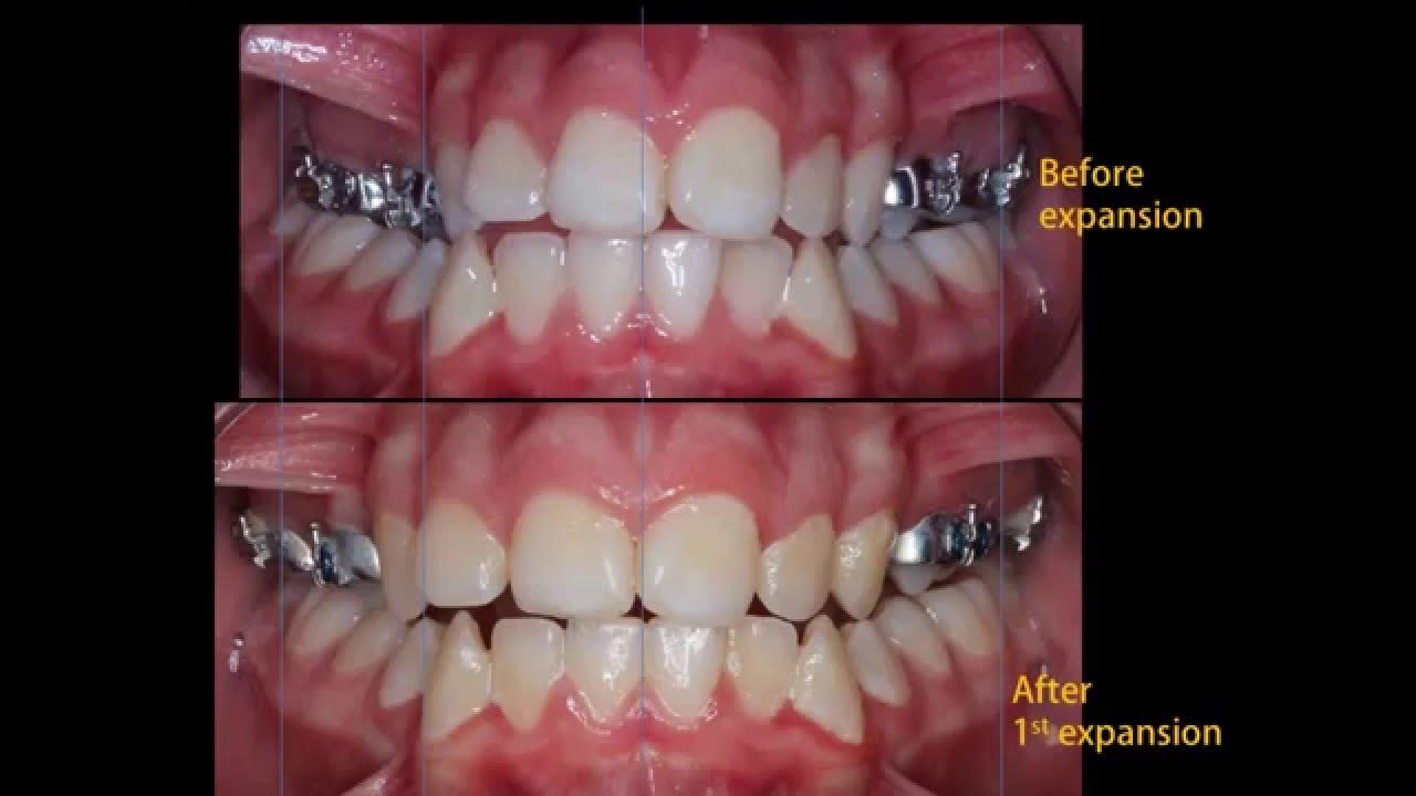 Orthodontics for Dummies YouTube