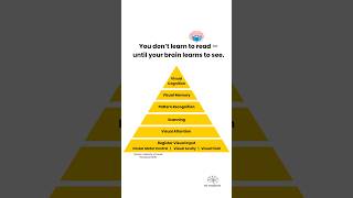CVI Cortical/Cerebral Visual Impairment - Hierarchy of vision processing #cvi #vision #eyes