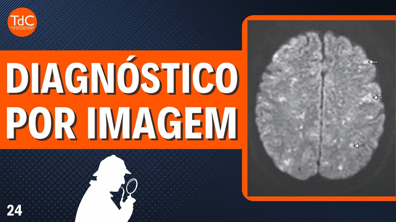 Thumbnail - "Rebaixamento de consciência após artroplastia de quadril" l Desafio TdC 24