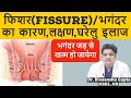 फिशर(भगंदर) के कारण,लक्षण,घरेलु इलाज बचाव,Fissure symptoms and cure, Fissure treatment at Home Hindi