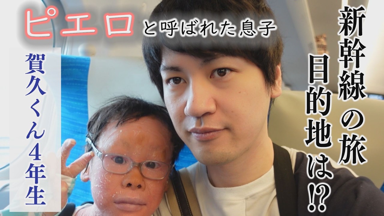 2026年 皮膚の難病・道化師様魚鱗癬と闘う~配信型ドキュメンタリー「ピエロと呼ばれた息子」第142話