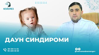 Даун синдироми  | ДОКТОР АСХОНОВ УЛУҒБЕК  #медицина #узбекистан