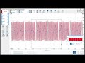 COMO SE HACE EL ANALISIS DE LA SINCRONIZACION DEL CKP Y CMP EN UN TOYOTA COROLLA 2007 P0016