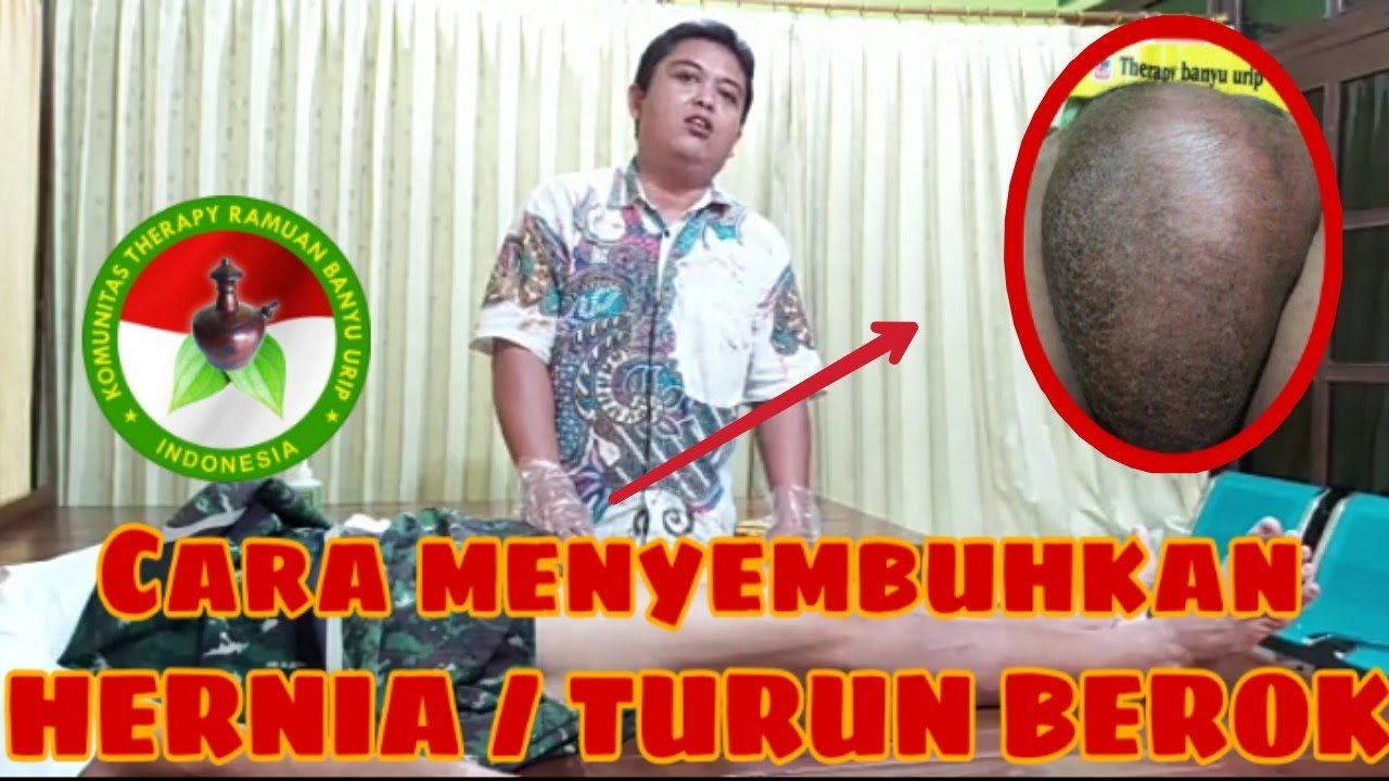 Cara memyembuhkan HERNIA/TURUN BEROK dengan Cepat | |Therapy banyu urip