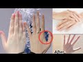 Exercise for Fingers | 30 Day to Have Beautiful, Slim Hands | Exercise for fat hands,elongate finger