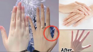 Exercise for Fingers | 30 Day to Have Beautiful, Slim Hands | Exercise for fat hands,elongate finger