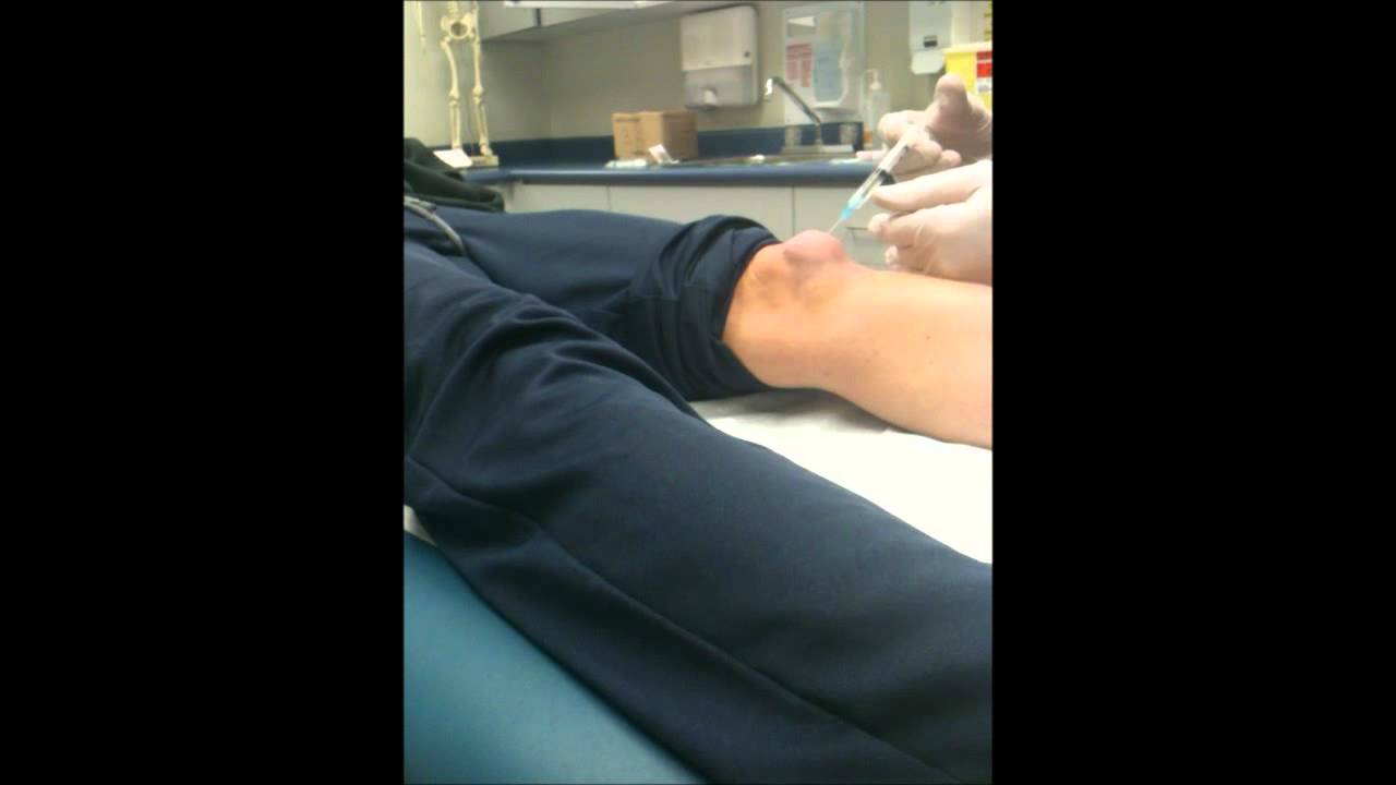 Knee drain - YouTube