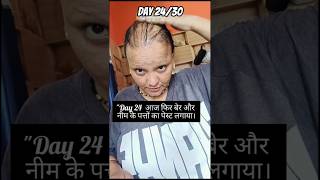 Day 24/ 30 alopecia women 🙏#lyrics #haircare #motivation