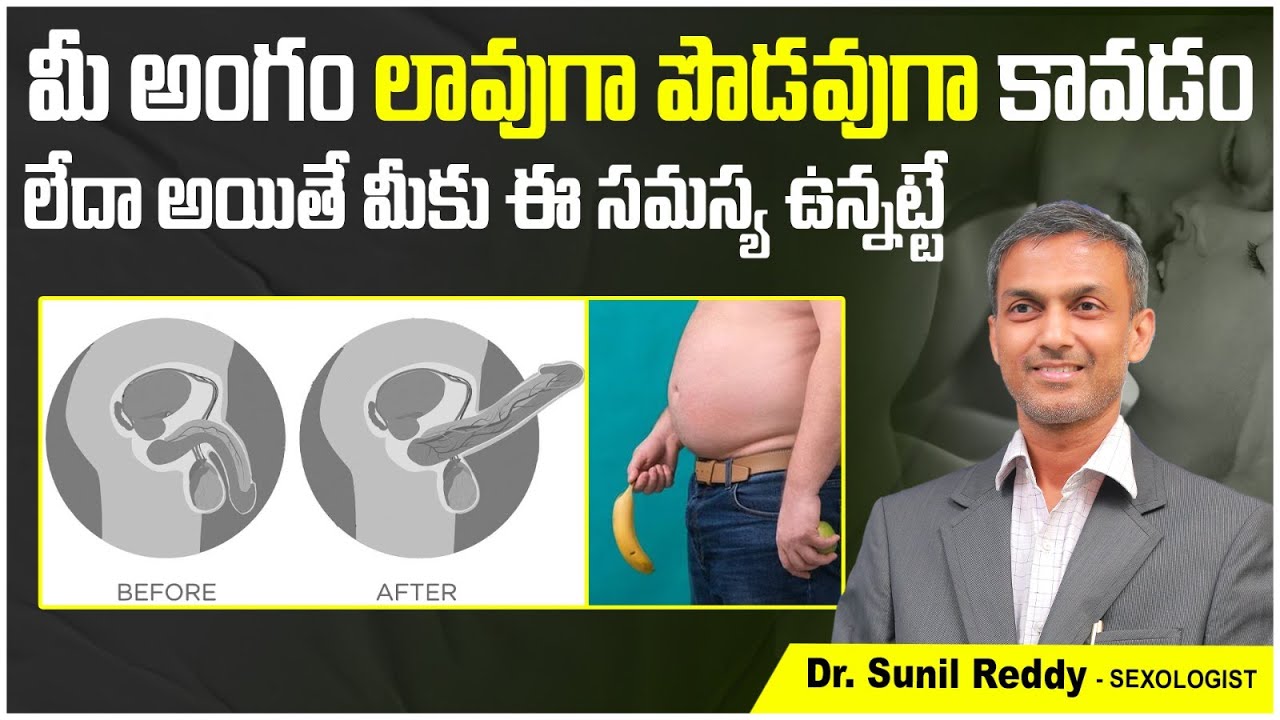 Vasculogenic Erectile Dysfunction Causes || Erectile Dysfunction Causes ...