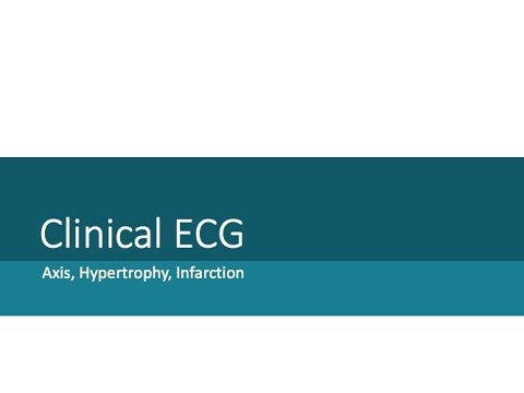 5.2-12 Lead ECG 3 environmental tech