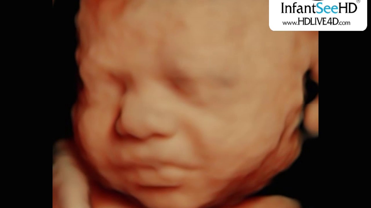 CLEAR ULTRASOUND AT 28 WEEKS IN HD LIVE 4D TECHNOLOGY SONOGRAM YouTube