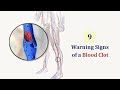 9 Warning Signs of a Blood Clot That You Should Never Ignore !!