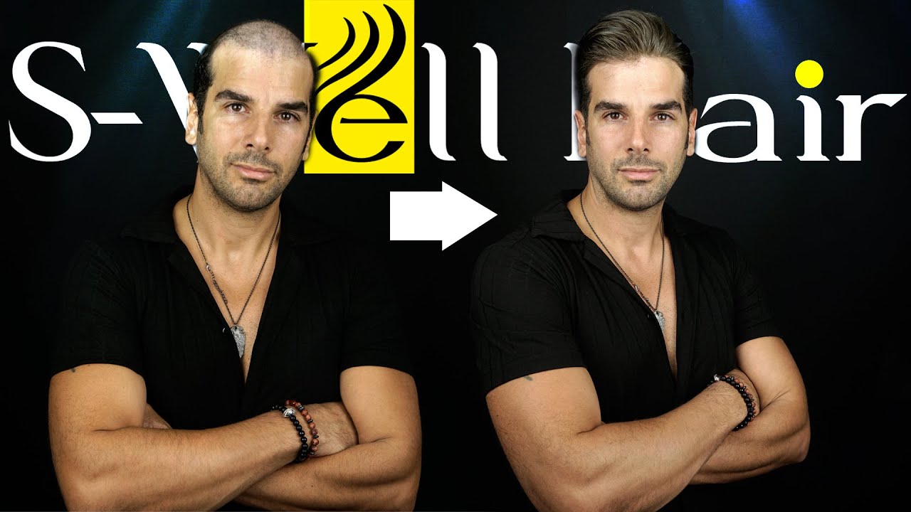 Protez Saç A8 Modeli - Hair Replacement