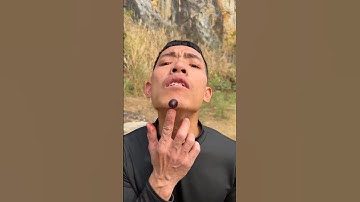 🌺😅🍂😁🌄😗☃️🤥👺😽💦🐢How I Cured a BugBite with Yogurt in the Wild Survival#sound#funny #shorts#viral