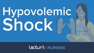 Hypovolemic Shock Medical Surgical Nursing