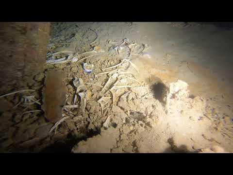 【閲覧注意】骨 YouTube