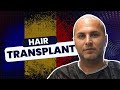 My experience with istanbul vita from romania  hair transplant in istanbul  turkey