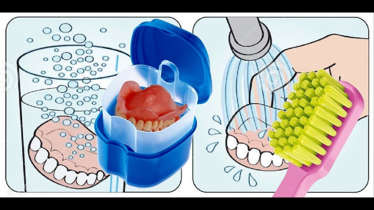 Гастроскопии можно чистить зубы. Гигиена зубов. Уход за зубными протезами. Специальная щетка для чистки зубных протезов.