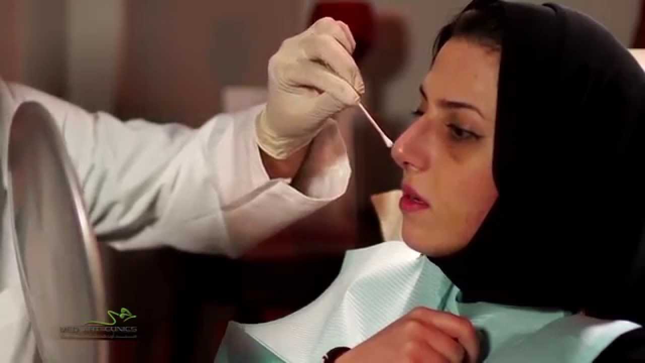 عملية تجميل الأنف - دكتور جمال جمعه Rhinoplasty by Dr. Jamal Jomah