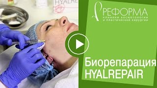 Процедура Биорепарация Гиалрепайер® в клиниках