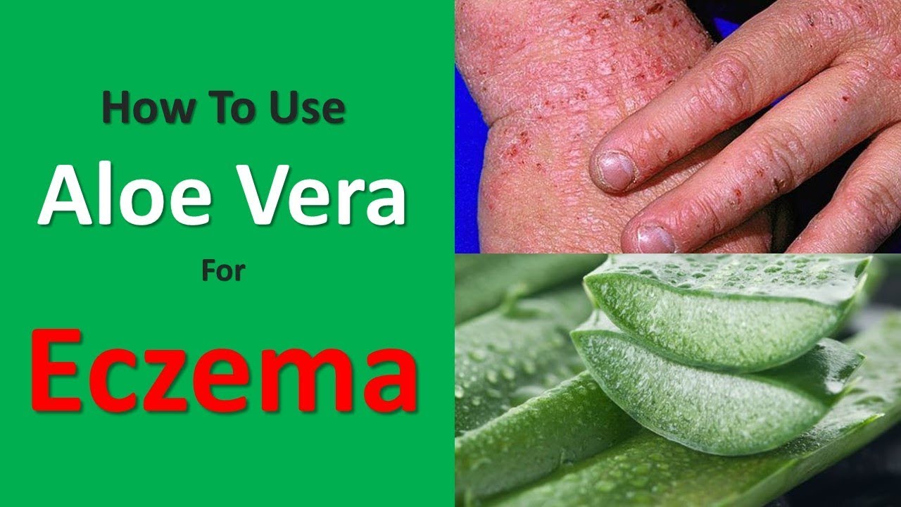 How To Use Aloe Vera For Eczema Aloe Vera With E Vitamin Oil