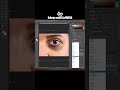 "How to Remove Dark Circles Fast &amp; Naturally!"