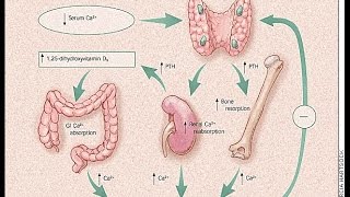 Hyperparathyroidism