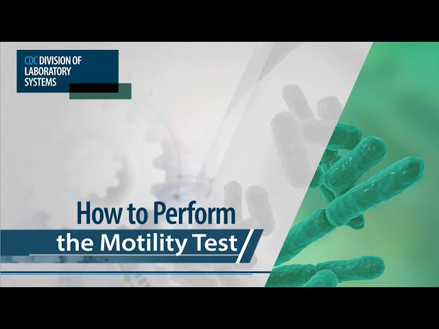 How to Perform the Motility Test