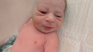 Unique newborn baby just after birth is different from ordinary #beautiful