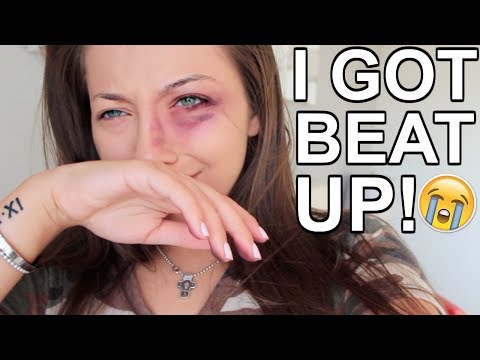 i-got-beat-up!-prank-on-boyfriend!!!