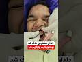 دندان مصنوعی حذف شد جایگزین اوردنچر 02188972000 تماس دندانپزشکی Dentist اوردنچر زهره 