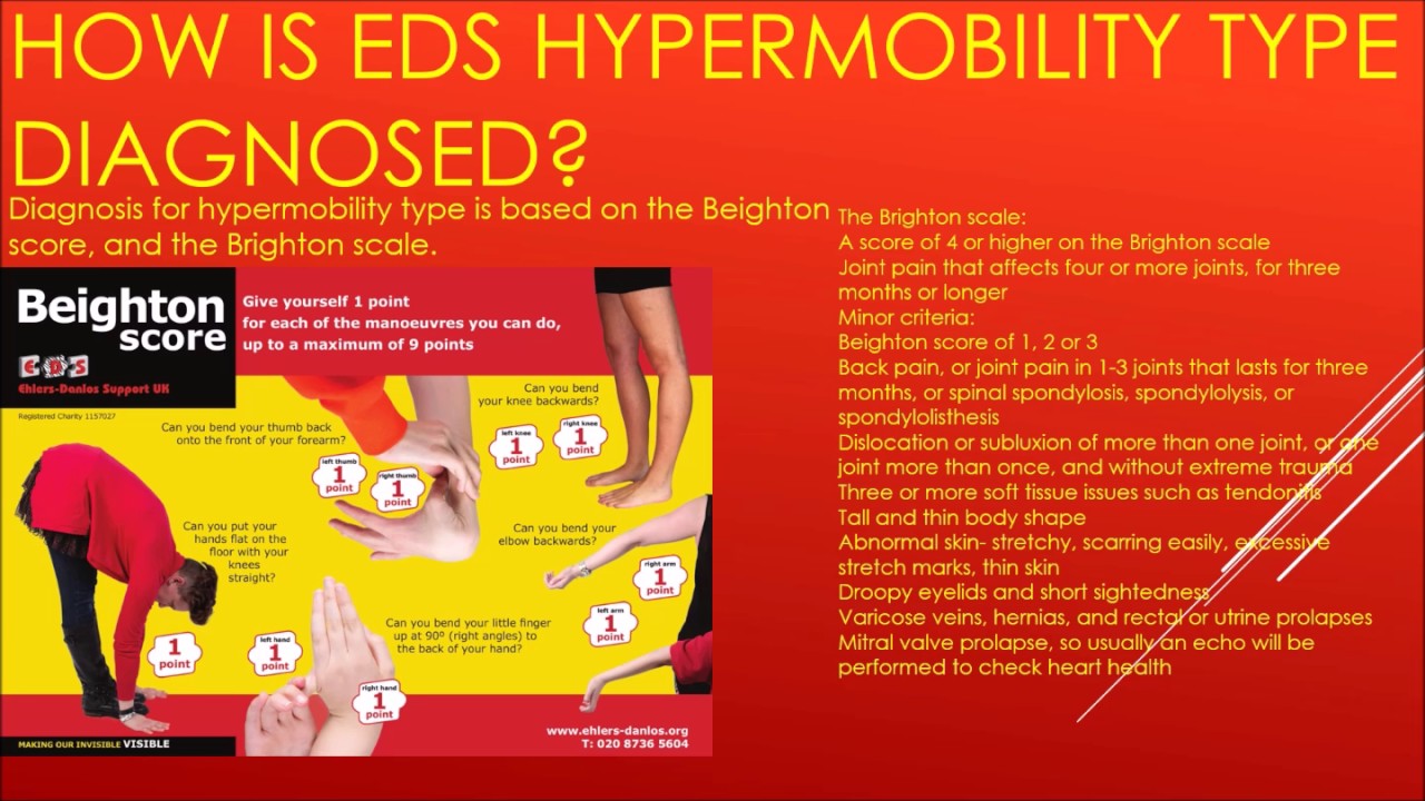 Health message for EhlersDanlos Syndrome YouTube