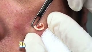 GROSS ANATOMY: Caught On Camera!