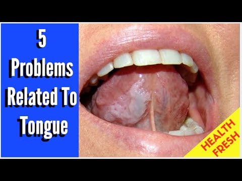 5 Problems Related To Tongue || Health Fresh - YouTube