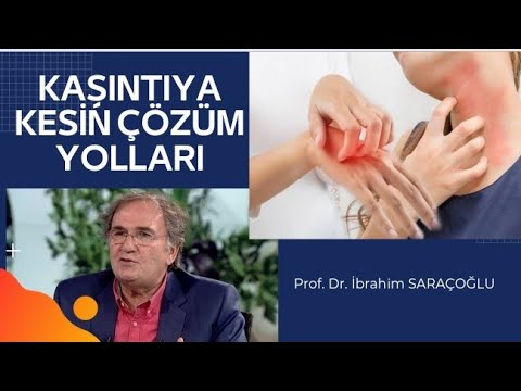 Video: Avuç İçi Kabarcıklardan Nasıl Kurtulur: 10 Adım (Resimlerle)