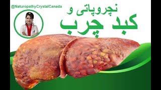 همه چیز در مورد کبد چرب و بهبود آن با نچروپاتی